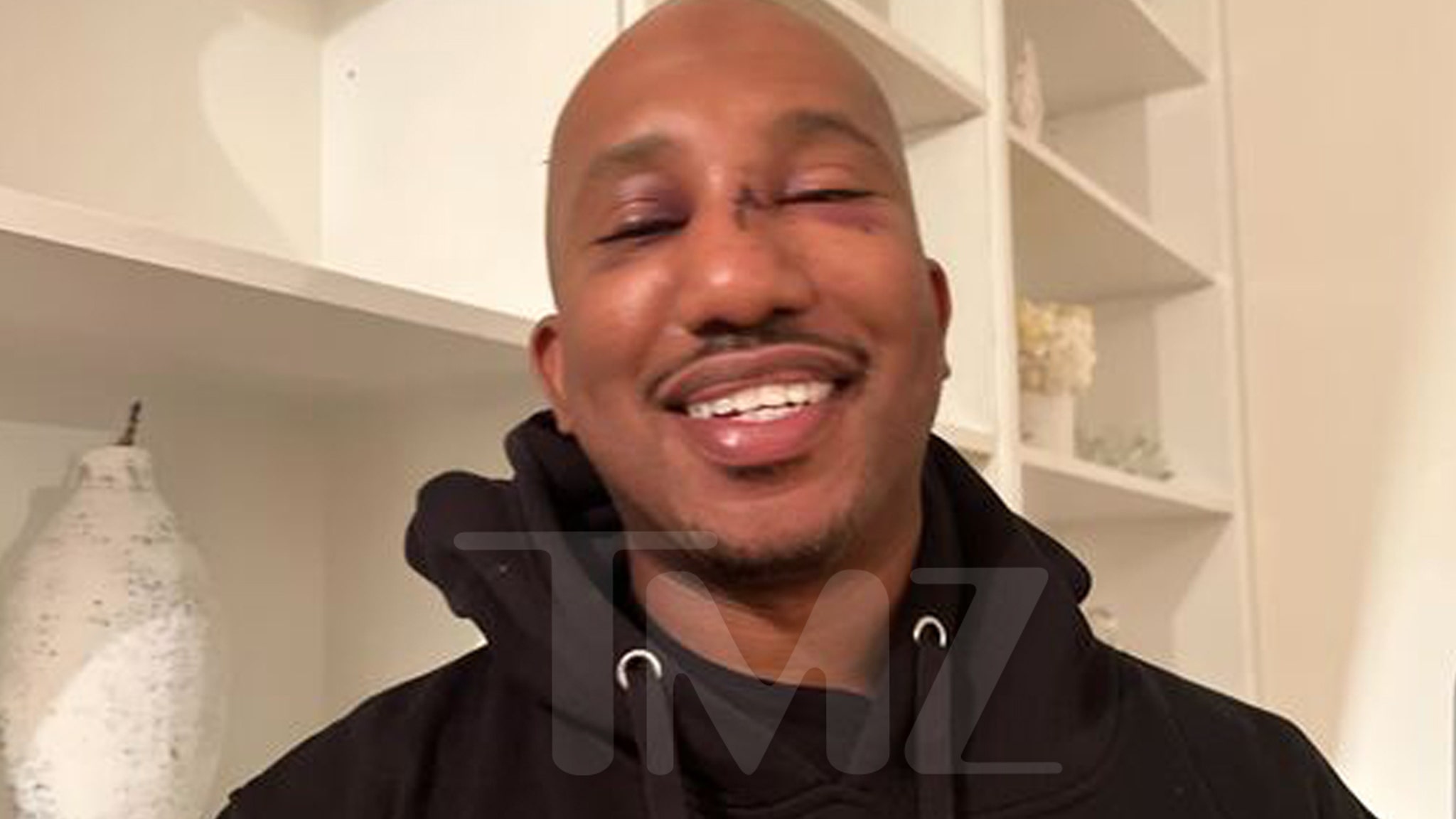 ‘SNL’ Star Chris Redd Injury Photos From Brutal Attack